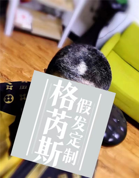 織發補發